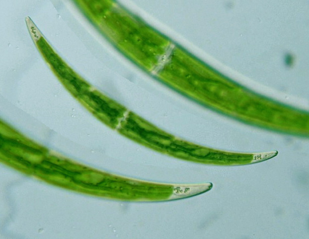 Closterium dianae