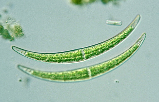 Closterium dianae