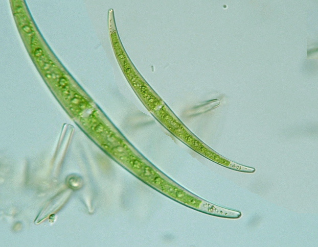 Closterium dianae