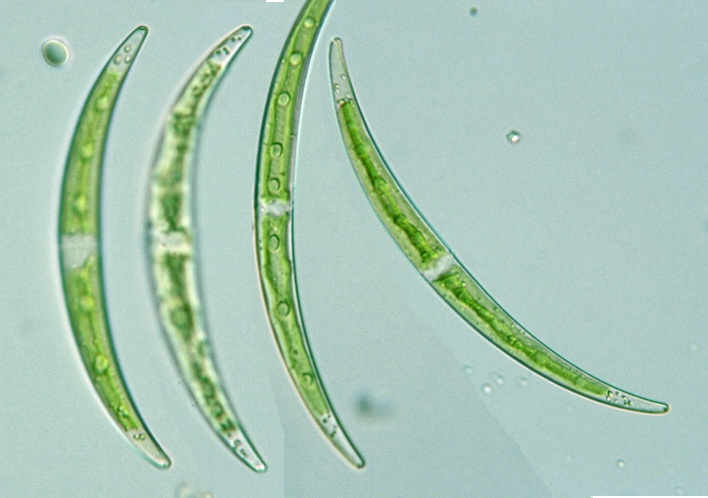 Closterium dianae