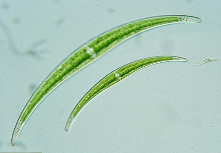 Closterium dianae