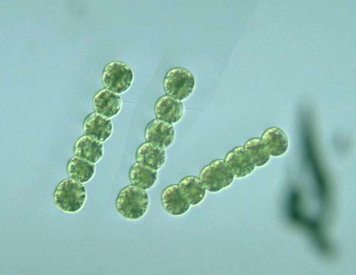 anabaena bacteria