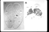Paramecium caudatum, micronuclei during conjugation