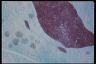 Paramecium caudatum, cell division