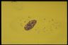Paramecium caudatum, Cells stained with Azure C