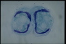 Euplotes eurystomus