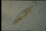 Paramecium caudatum, intact cells