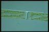 Spirogyra