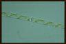 Spirogyra