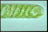 Spirogyra