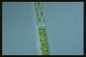 Spirogyra