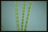 Spirogyra