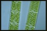 Spirogyra