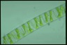 Spirogyra