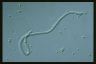 Climacostomum virens