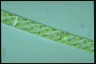 Spirogyra