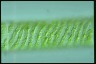 Spirogyra