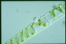 Spirogyra Rhyzophydium