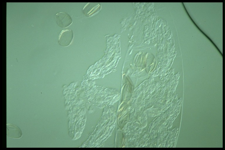 protist image