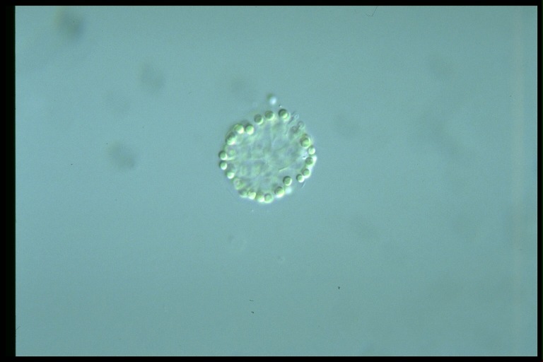 protist image