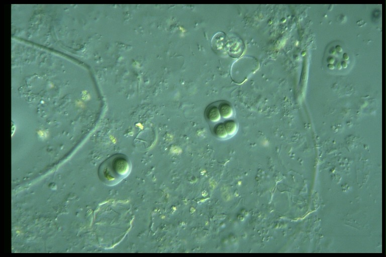 protist image