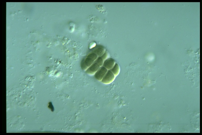 protist image