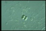 Chroococcus turgidus