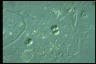Chroococcus turgidus