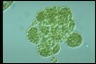 Microcystis