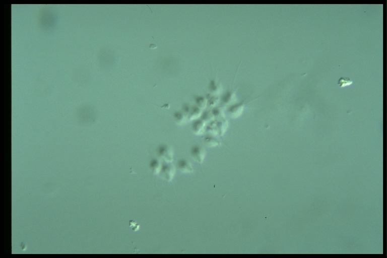 protist image