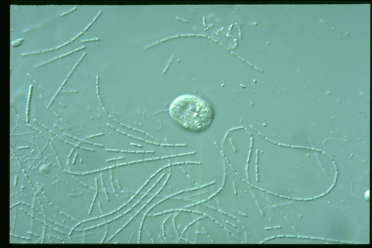 protist image