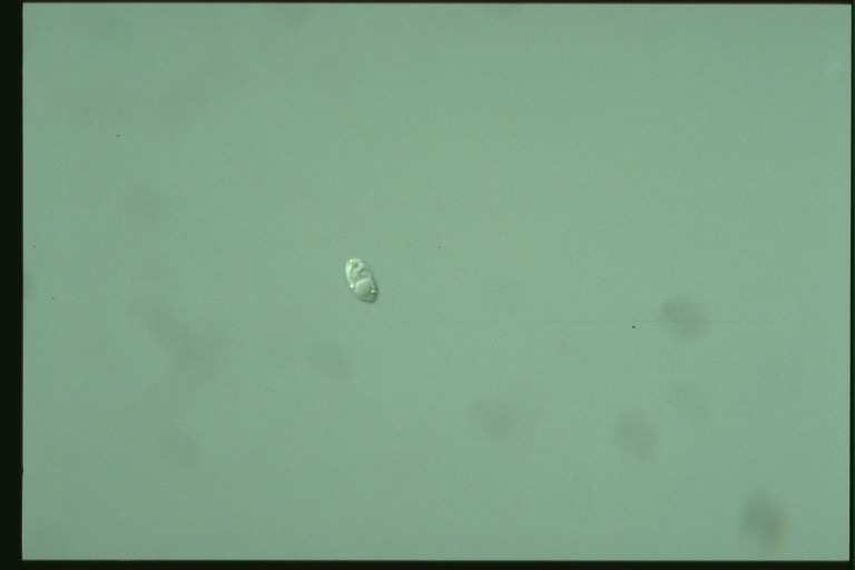 protist image