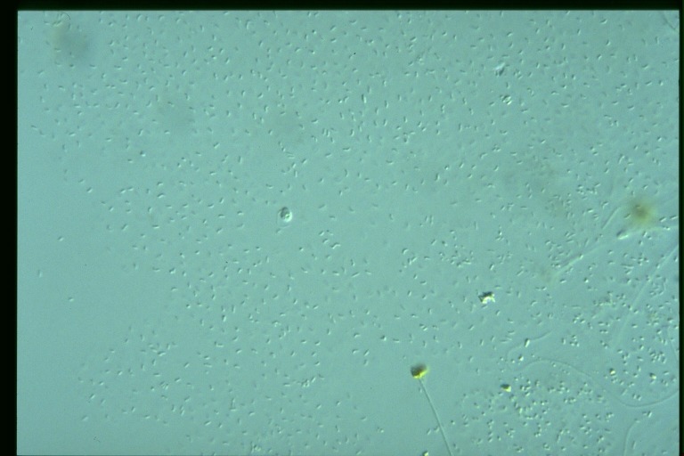 protist image