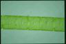 Spirogyra