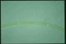 Spirogyra