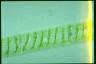 Spirogyra