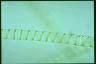 Spirogyra