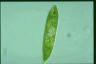 Euglena spirogyra