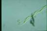 Spirogyra