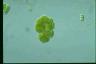 Botryococcus braunii