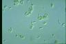 Stichococcus