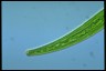 Closterium intermedium