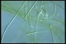 Anabaenopsis raciborskii