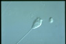 Vorticella microstoma