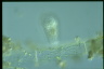 Euglypha tuberculata