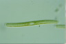 Nitzschia sigmoidea
