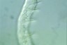 Chaetogaster limnaei