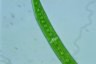 Closterium intermedium