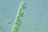 Spirogyra