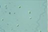 Oocystis